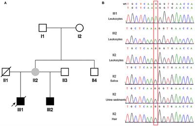 Detection of Very Low-Level Somatic Mosaic COL4A5 Splicing Variant in Asymptomatic Female Using Droplet Digital PCR